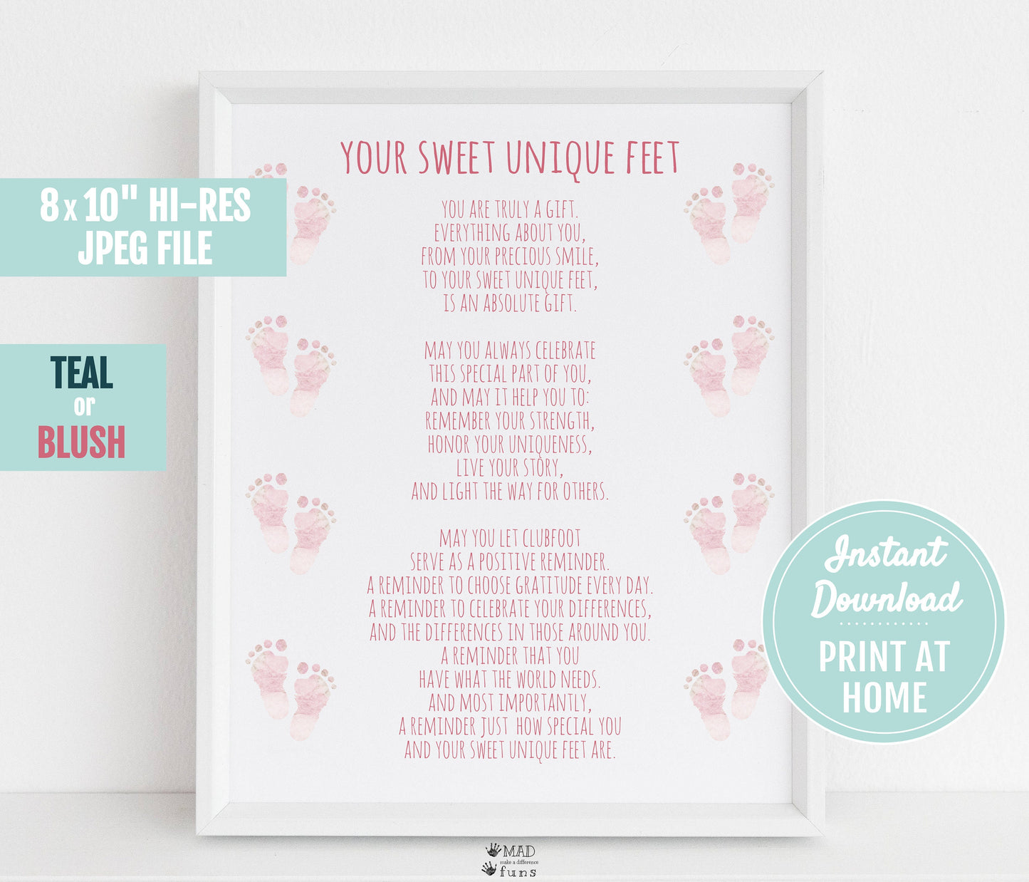 Clubfoot Poem Your Sweet Unique Feet Digital Downlad | 8x10 Print At Home | Printable Nursery Room Decor| Clubfoot Cuties Prayer | TEV